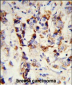 SKIV2L2 Antibody (Center)
