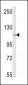SKIV2L2 Antibody (Center)