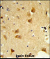 DERL1 Antibody (C-term)