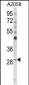 CD151 Antibody (Center)