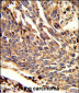 ARPC1B Antibody (Center)