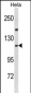 IPO11 Antibody (N-term)