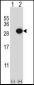 CTHRC1 Antibody (N-term)