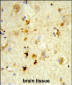 ITGBL1 Antibody (Center)