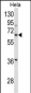 ITGBL1 Antibody (Center)