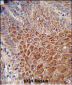 IGH Antibody (C-Term)