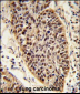 XPA Antibody (C-term)