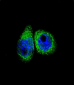 CYP7B1 Antibody (Center)