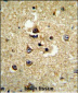 CYP7B1 Antibody (Center)