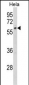 CYP7B1 Antibody (Center)