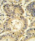 SOCS1 Antibody (N-term)