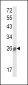 SOCS1 Antibody (N-term)