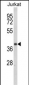 CCR3 Antibody (Center)