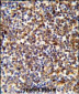 COTL1 Antibody (C-term)