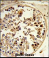 ASPSCR1 Antibody (C-term)