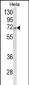 ASPSCR1 Antibody (C-term)