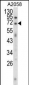 EWSR1 Antibody (C-term)