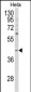 NCK1 Antibody (N-term)