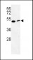 PISD Antibody (Center)