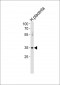 ATF7 Antibody (N-term)