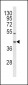 OLR1 Antibody (Center)