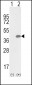 OLR1 Antibody (Center)