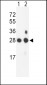 PSMB1 Antibody (C-term)