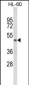 PTGER2 Antibody (Center)