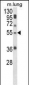 SELENBP1 Antibody (C-term)