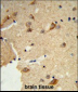 DTX4 Antibody (N-term)