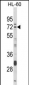 DTX4 Antibody (N-term)