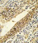 CYP51A1 Antibody (Center)