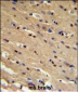 TP73 Antibody (Center)