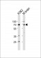 TP73 Antibody (Center)