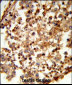 C1QTNF6 Antibody (N-term)
