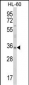 TNFSF11 Antibody (N-term)