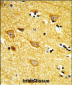 INPP4B Antibody (Center)