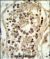 ABHD12 Antibody (N-term)
