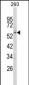 FOXC1 Antibody (C-term)