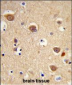 AIFM1 Antibody (N-term)