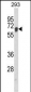 AIFM1 Antibody (N-term)