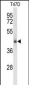 CLN5 Antibody (N-term)
