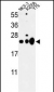 CBX1 Antibody (C-term)