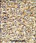 DTX1 Antibody (Center)