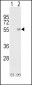 HP Antibody (Center)