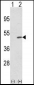 TRIB2 Antibody (N-term)