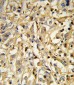IL21 Antibody