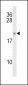 IL21 Antibody