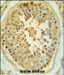 LMX1B Antibody (Center)