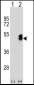 LMX1B Antibody (Center)